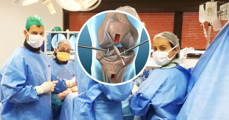 Cirurgia de joelho conheça as mais comuns Dr Renato Morelli